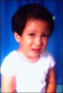 Alyana "Yana" Clarisse Evans, aged 4. In the Philippines, before her overseas surgery.