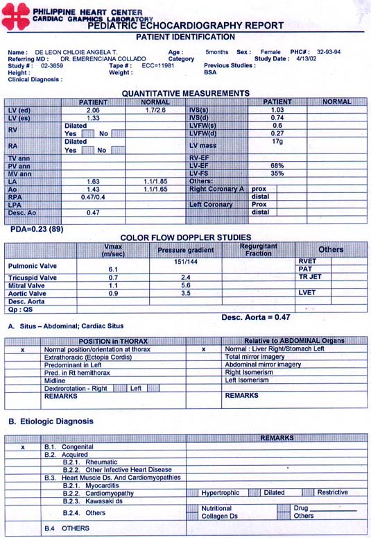 Chloie Angela T. de Leon, 6 months - Pediatric Electrocardiography Report