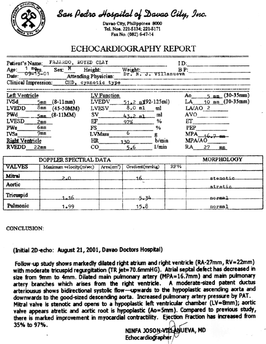 Heart Ailment, Echocardiography Report from San Pedro Hospital of Davao City, Philippines. Royed Fajardo, 5 months, Medical Document 02, for evaluation 2002