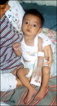 Royed Fajardo, baby 5 months,  Jan 2002. Diagnosed Hypoplastic Left Heart Syndrome
