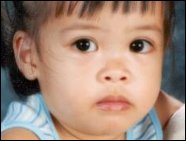 Jerden Sampang, 2 years old, Denied U.S. Visa for Lifesaving Surgery