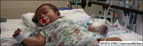 Lyrize Julienne Escoton, 11 months, after surgery.