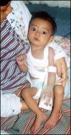 Royed Fajardo, 5 months, died in the Philippines 4:45 P.M. February 5, 2002. from his serious Congenital Ventricular Septal Defect.